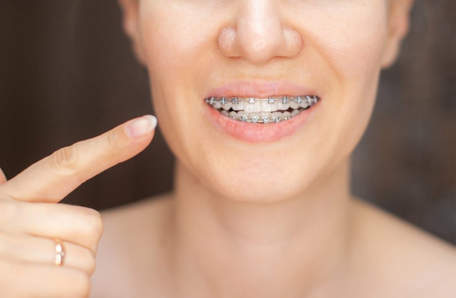 Most people know that braces straighten teeth—but few understand how they actually work...