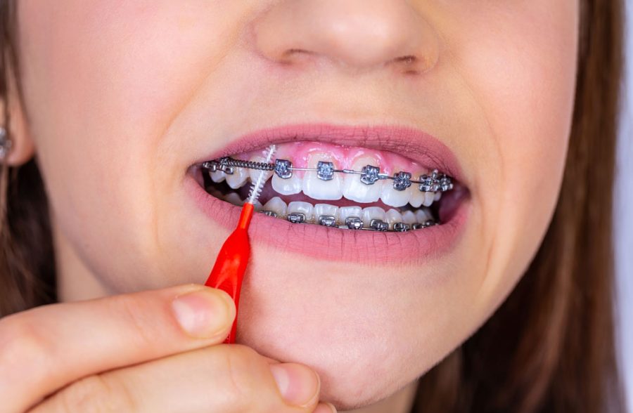 Orthodontics has come a long way from traditional metal braces, and the innovations shaping the future of the field are nothing short of revolutionary...