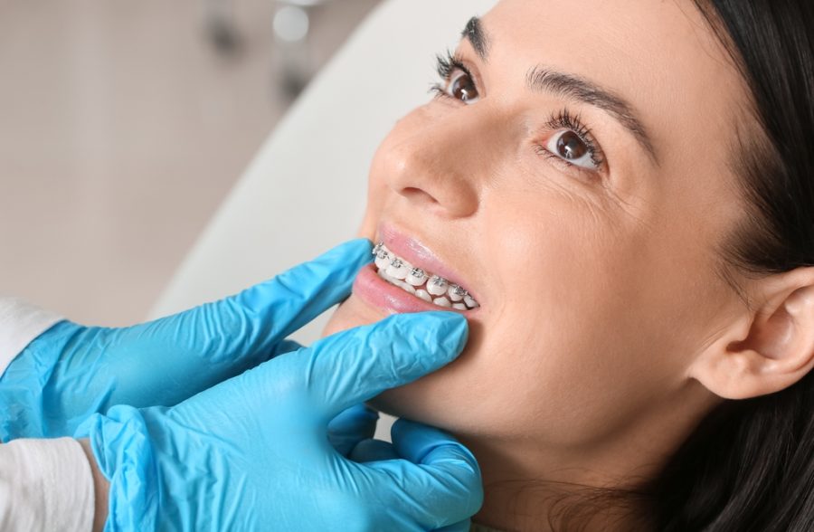 For many people, orthodontic treatment is something they associate with teenage years. However, more adults than ever are choosing to invest in their smiles later in life...
