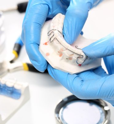 In-House-Orthodontic-Lab-img