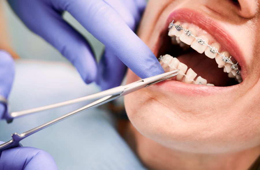 Choosing the best orthodontist in Montebello, CA can make a major difference in your smile, your comfort, and your overall treatment experience.